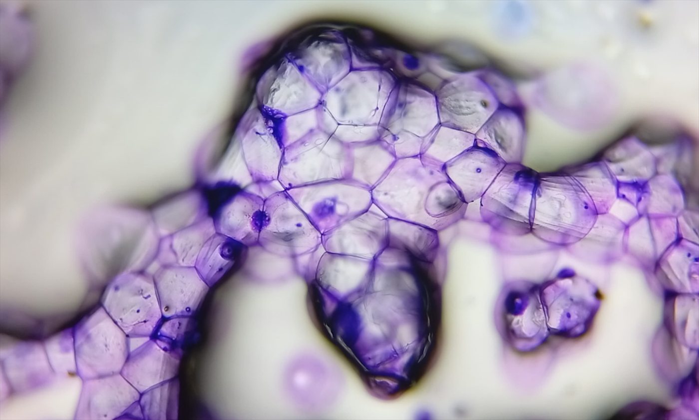 Células coradas em roxo vistas ao microscópio