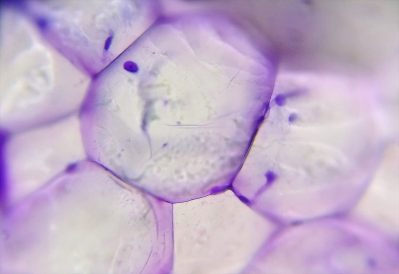 Lâmina de citopatologia ao microscópio