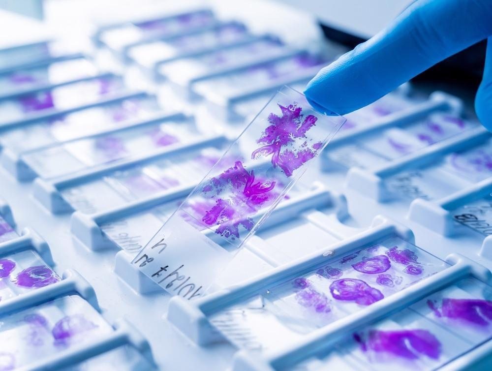 Lâminas coradas em bandeja de laboratório